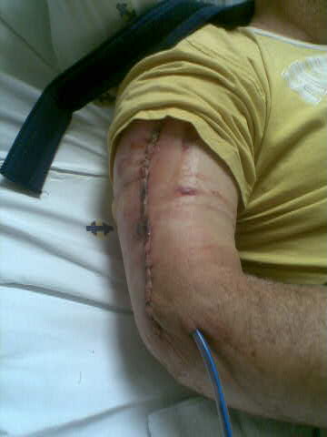 After_op.jpg